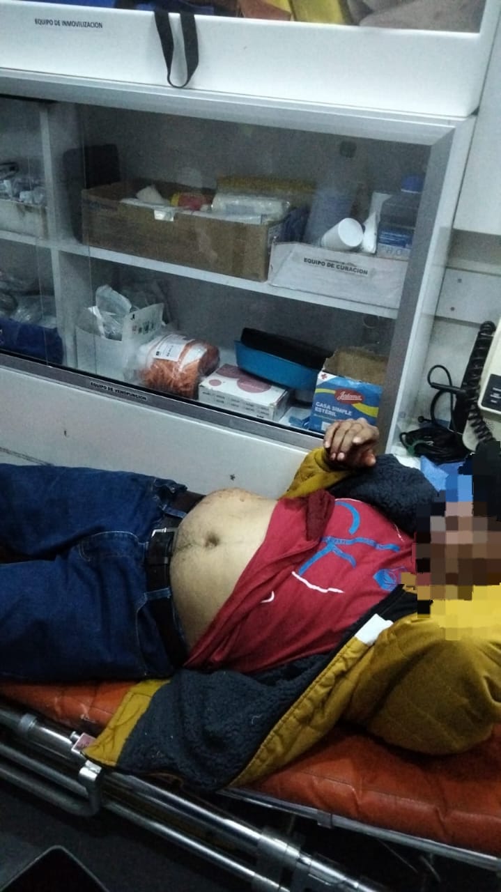 Intenta abrir una lata de sardina y se apuñala por accidente, en Atlangatepec