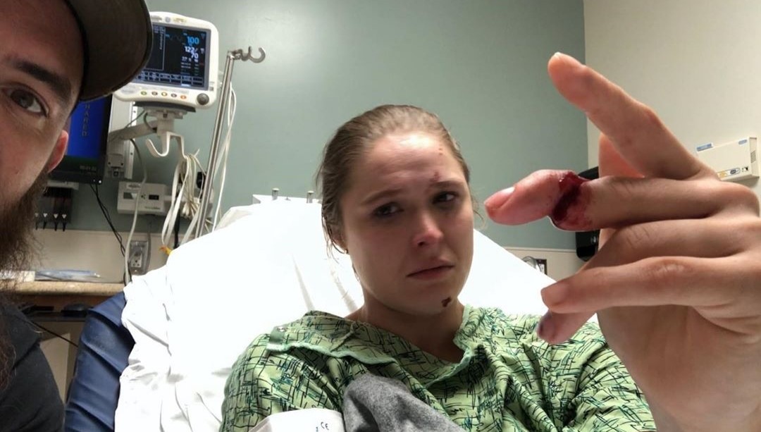 La luchadora Ronda Rousey mostró en instagram su dedo casi amputado