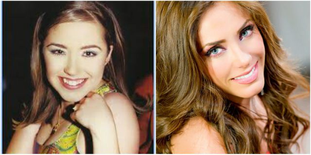 Anahí y su evolución física: ¿Qué cirugías ha realizado a lo largo del tiempo?