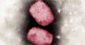 Según estudio esta es la principal vía de contagio de la viruela símica