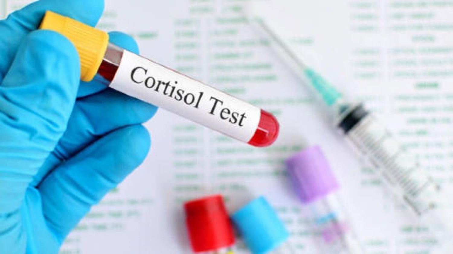 Exceso de cortisol: qué es, síntomas y cómo afecta la salud