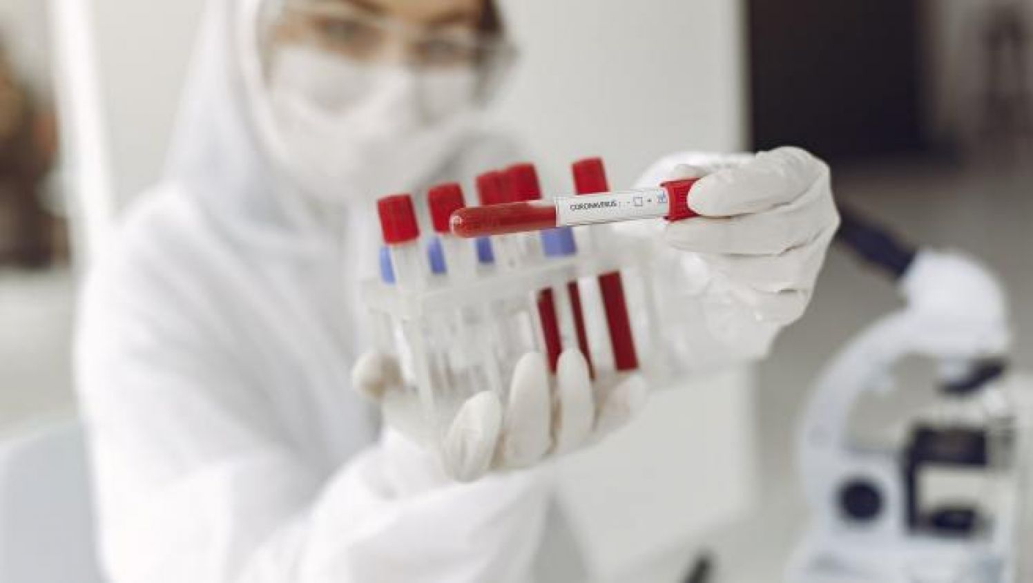 OMS busca más información de la vacuna rusa contra el COVID-19