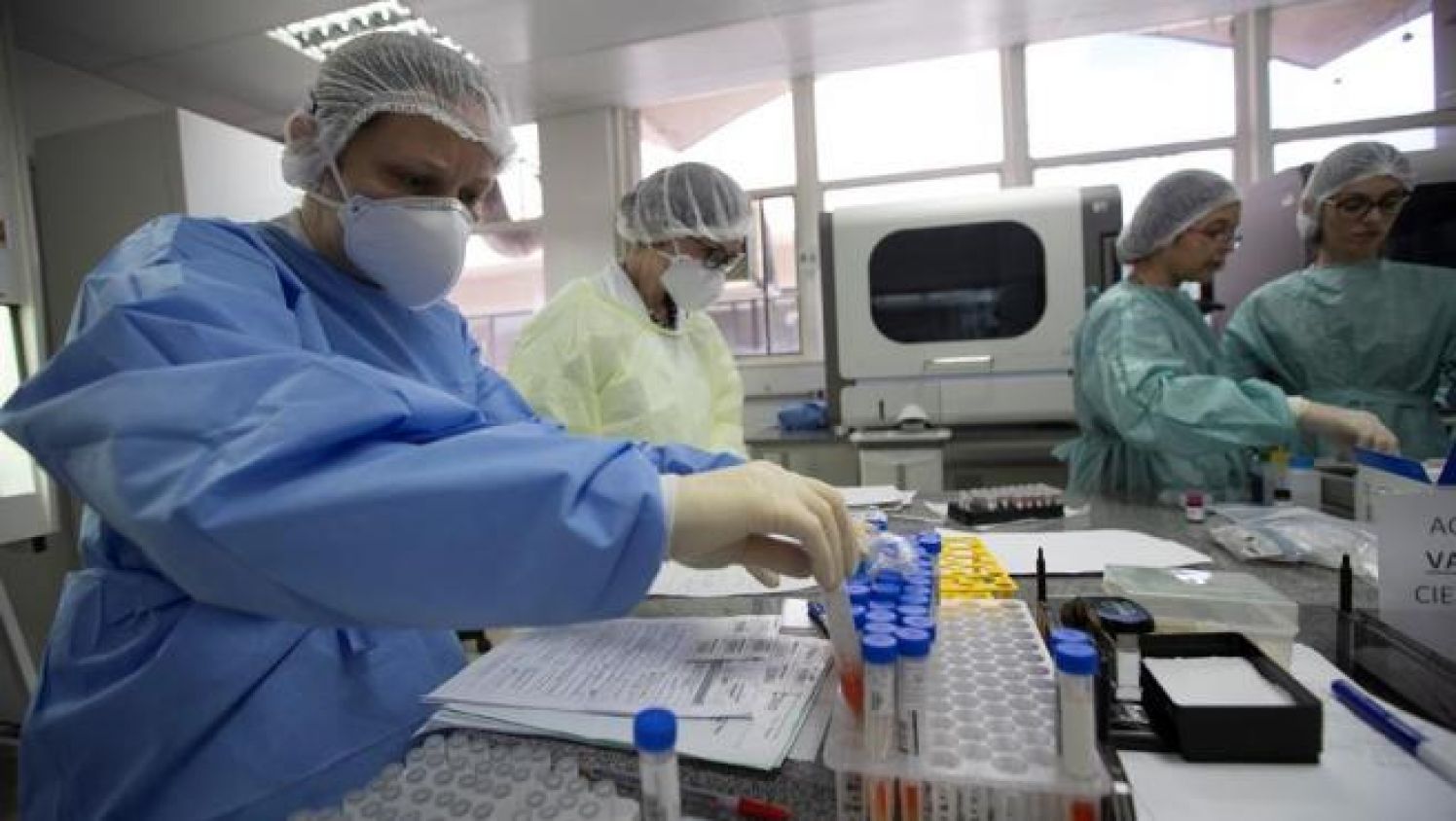 EU da aprobación de emergencia a kit para detectar COVID-19 de empresa china