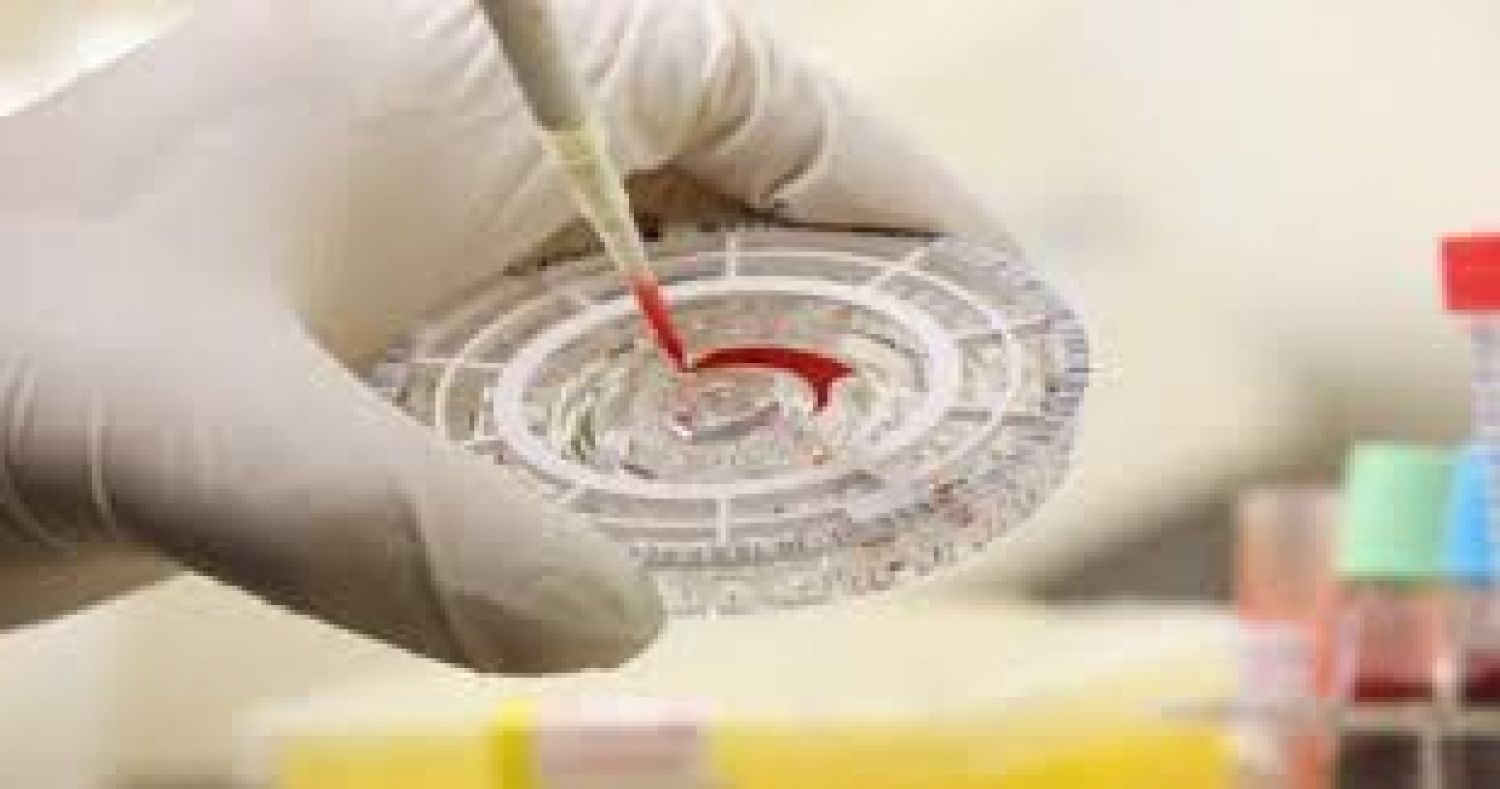 ¿Qué es el virus Chapare, el misterioso patógeno reportado en Bolivia?