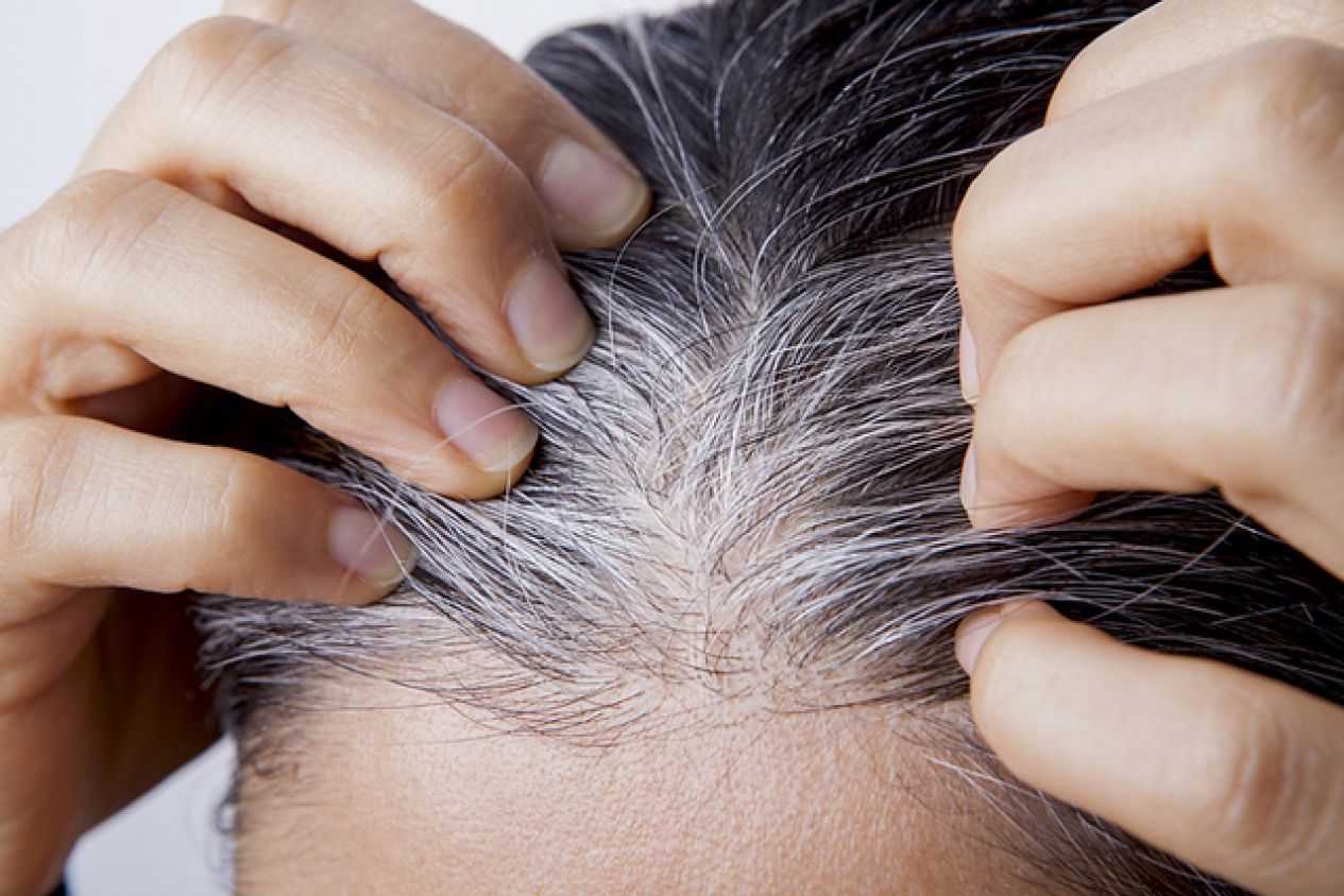 Descubren que las canas pueden volver a su color natural y la clave para lograrlo 