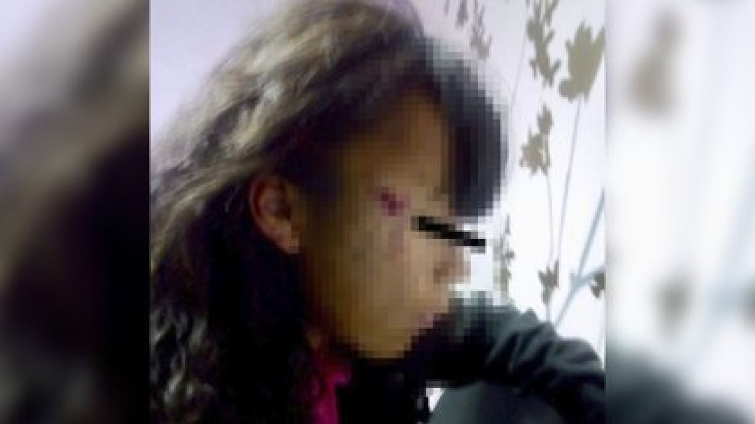 Hombre intenta abusar de niña de 11 años, al forcejear le marcó el rostro de por vida