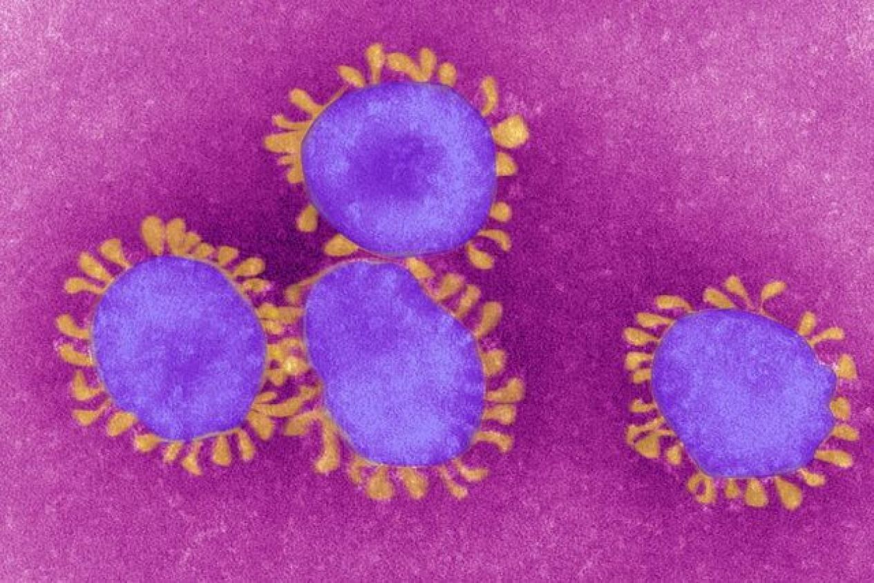 Descubren un nuevo coronavirus en Malasia que podría transmitirse de perros a humanos
