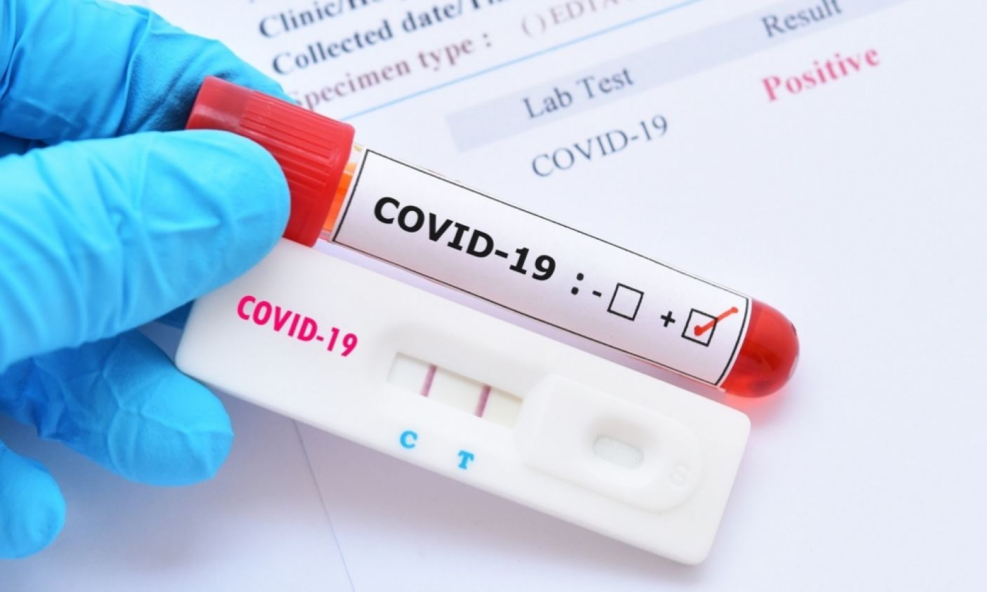 La OMS estudia una nueva variante de coronavirus detectada en Colombia