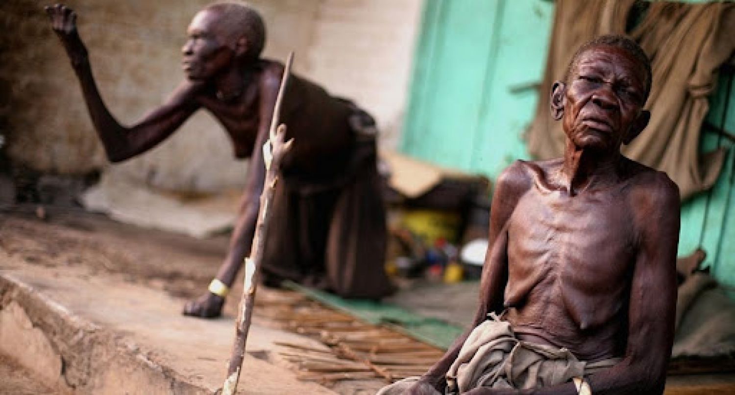 Por la pandemia más de 45 millones de personas se encuentran al borde de la hambruna: ONU