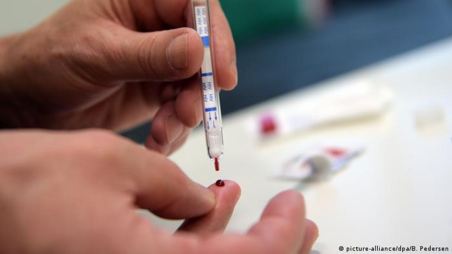 En un lapso de 20 minutos, el VIH ya es diagnosticado con pruebas desechables