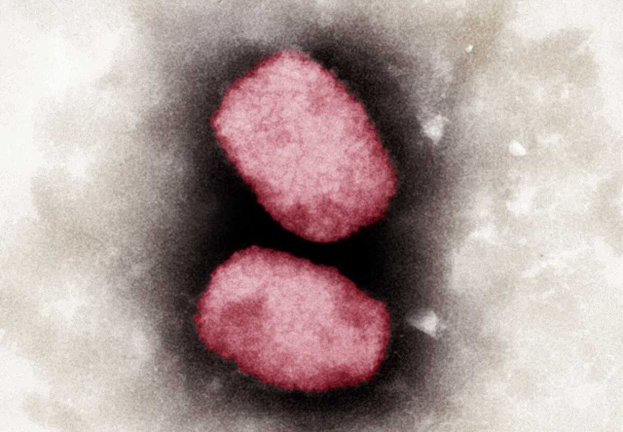 Según estudio esta es la principal vía de contagio de la viruela símica
