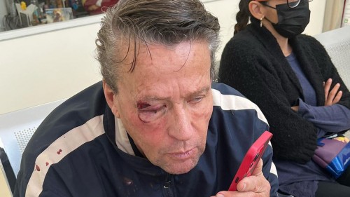 Recibe Alfredo Adame brutal golpiza presuntamente por 'malandros', ya fueron detenidos
