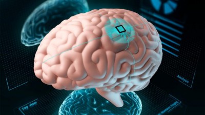 Neuralink recibe aprobación de la FDA para hacer ensayos de su interfaz cerebro-ordenador 