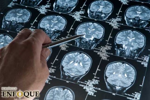 800 Mil personas padecen alzheimer en méxico, según unam