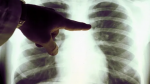 Foto: Cortesía Ilustración médica del sistema linfático humano.